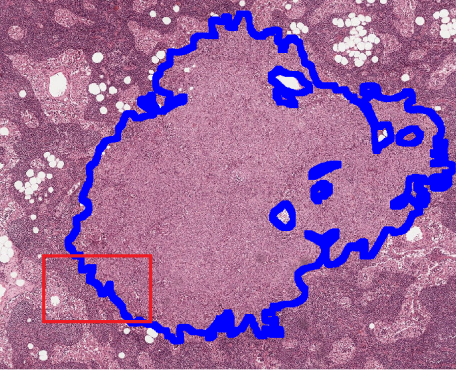 Pathology Use Case