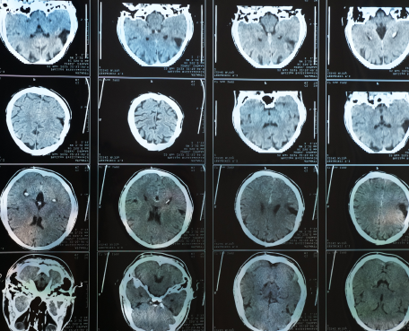 Radiology Use Case